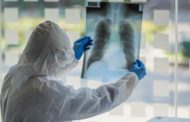 Как не допустить осложнений при КВИ: рекомендации врачей