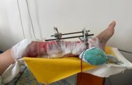 Рабочий завода «СарыаркаАвтоПром» получил серьёзную травму на производстве